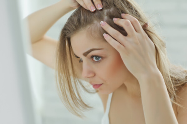 Principales tratamientos por la caída de pelo por estrés
